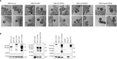 Different configurations of SARS-CoV-2 spike protein delivered by integrase-defective lentiviral vectors induce persistent functional immune responses, characterized by distinct immunogenicity profiles